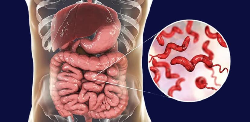 Cách chữa viêm dạ dày ruột hiệu quả