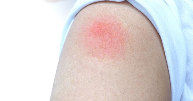 Tác dụng phụ có thể xảy ra sau khi tiêm vắc xin Havax