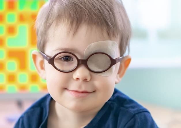 mắt bé bị lác trong