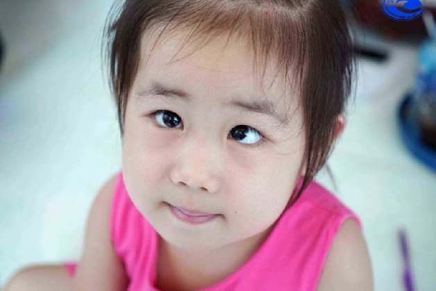 lác mắt ở trẻ