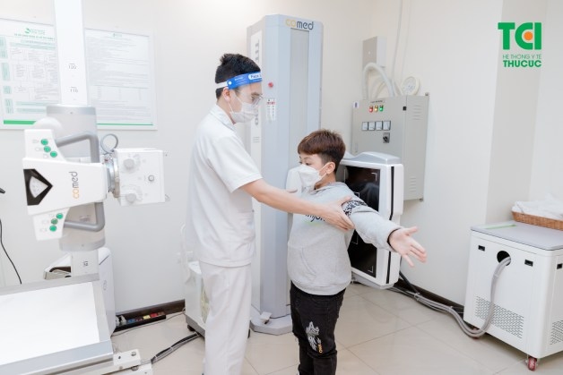 cong vẹo cột sống ở trẻ