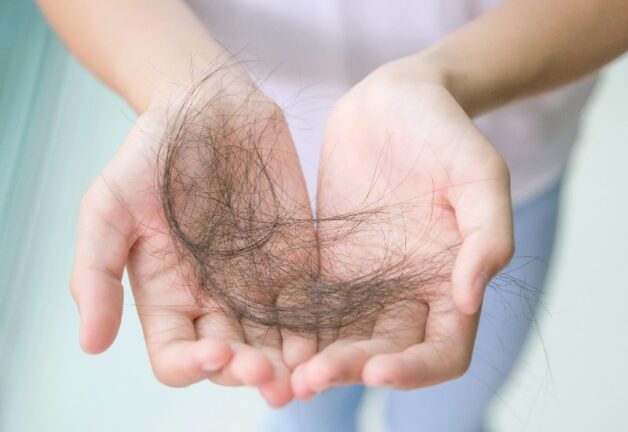 Bệnh tuyến giáp gây rụng tóc là nỗi ám ảnh của nhiều bệnh nhân