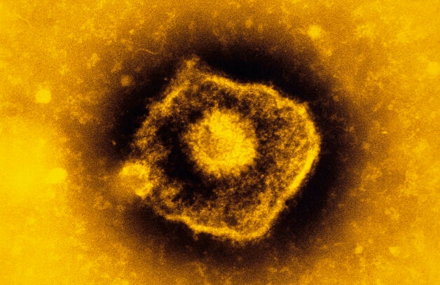 Nguyên nhân phát sinh bệnh truyền nhiễm cấp tính thủy đậu được xác định là virus Varicella-Zoster.