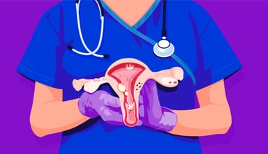Tất cả thông tin về bệnh ung thư buồng trứng giai đoạn 2