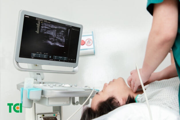 Chọc hút tế bào tuyến giáp để chẩn đoán nhân giáp lành tính hay ác tính
