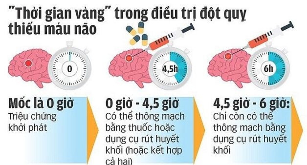 Thời gian vàng cần lưu ý trong cách khắc phục đột quỵ