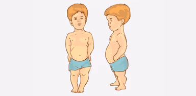 Dấu hiệu bệnh lùn tuyến yên