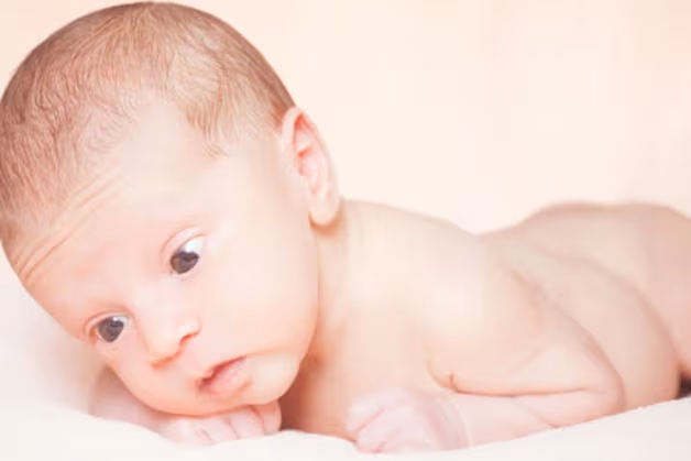 Nguyên nhân gây lác mắt