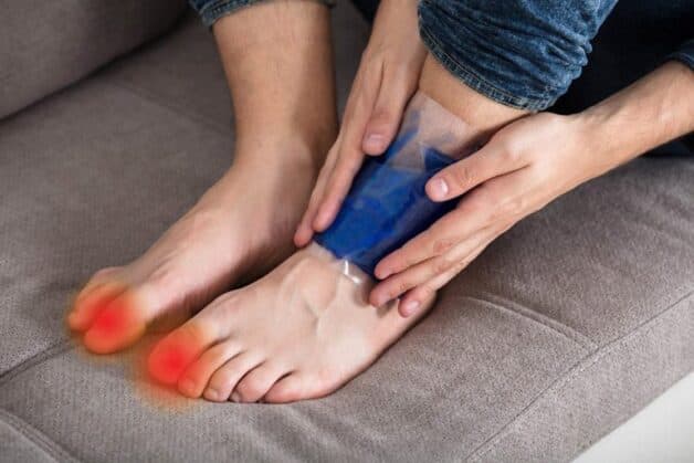 Cơn đau do viêm gout cấp tính thường đi kèm triệu chứng nóng đỏ, sưng tấy