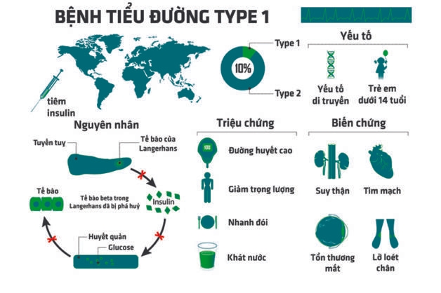 Người tiểu đường type 1 có nguy cơ mắc viêm tuyến giáp tự miễn
