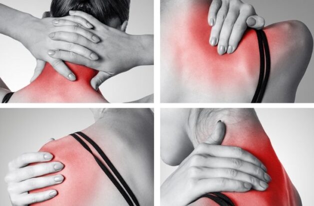 Điều trị hội chứng cổ vai cánh tay nhằm nâng cao chất lượng cuộc sống