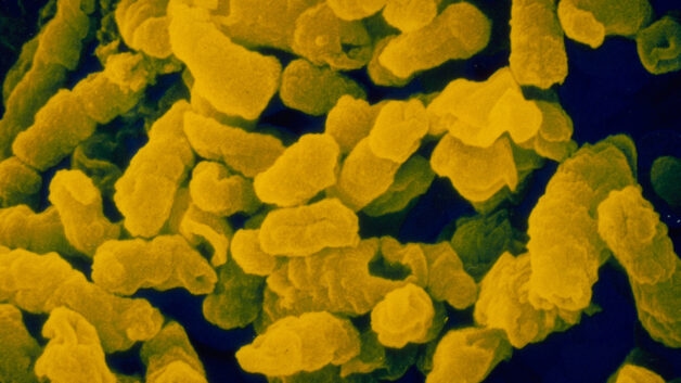 Đại diện gây viêm phế quản điển hình của nhóm vi khuẩn là Haemophilus influenzae.