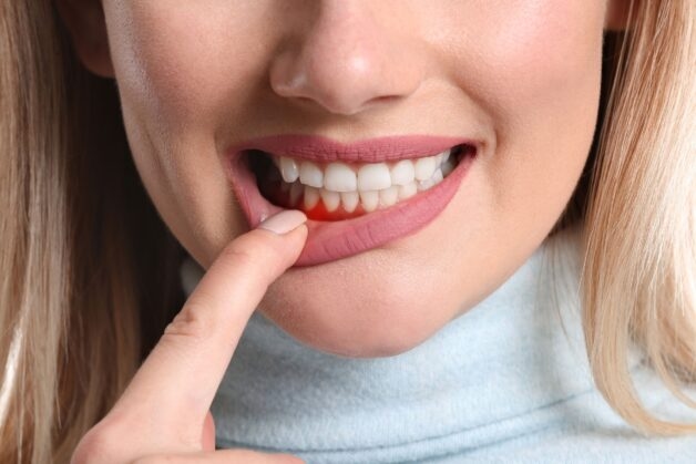 Người mắc bệnh tiểu đường có nguy cơ mắc một số bệnh lý răng miệng như viêm nướu, viêm nha chu,... cao hơn so với người bình thường.