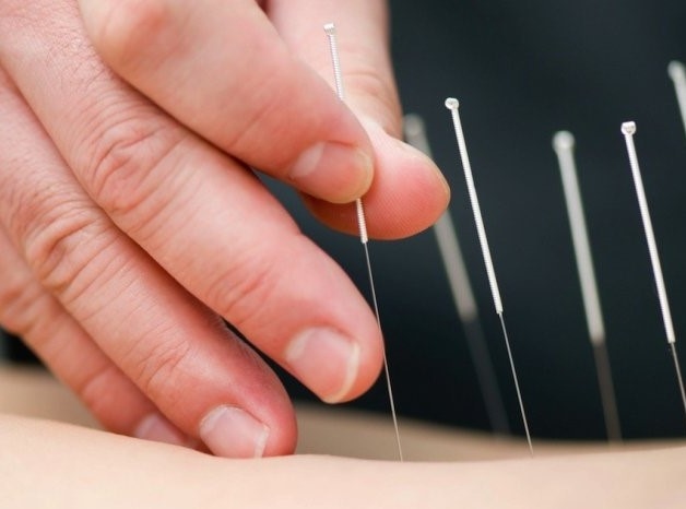 phục hồi tai biến mạch máu não