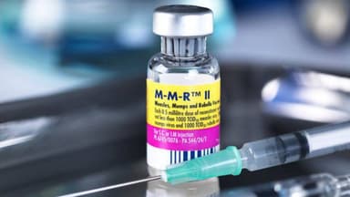 3 Lưu ý khi tiêm chủng vacxin phòng sởi – quai bị – rubella