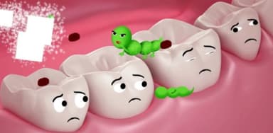 Bệnh sâu răng – Phòng ngừa và điều trị