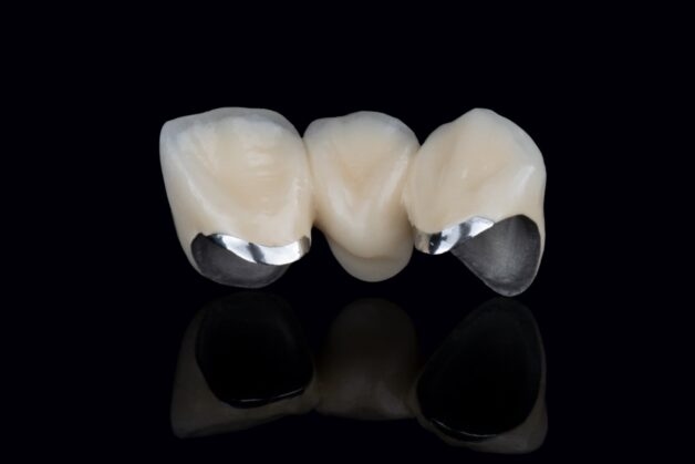 Giải đáp chi tiết thắc mắc: Bọc răng sứ độ bền bao lâu?