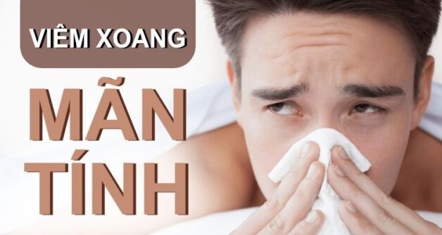 Tìm cách điều trị viêm xoang mãn tính