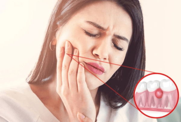 Giải đáp chữa sâu răng lồi thịt có đau không