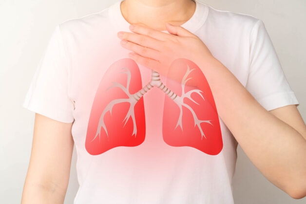Nguyên nhân viêm phế quản cấp thường do virus, vi khuẩn