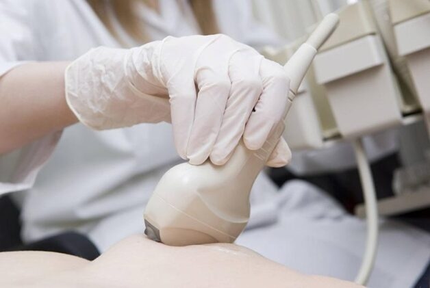 Công dụng của siêu âm tuyến vú