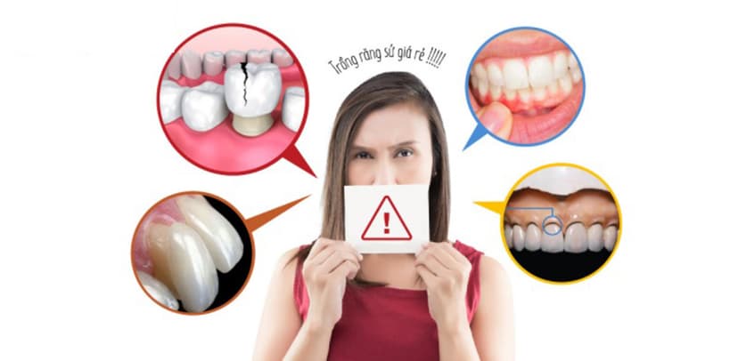 Cẩn trọng trước lời mời trồng răng sứ giá rẻ