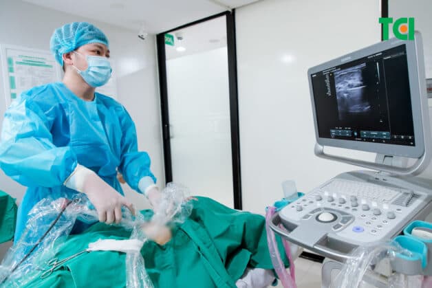 Sinh thiết u vú dưới hướng dẫn siêu âm và lực hút chân không (VABB) được sử dụng trong điều trị u vú BIRADS 4A tại Thu Cúc TCI.