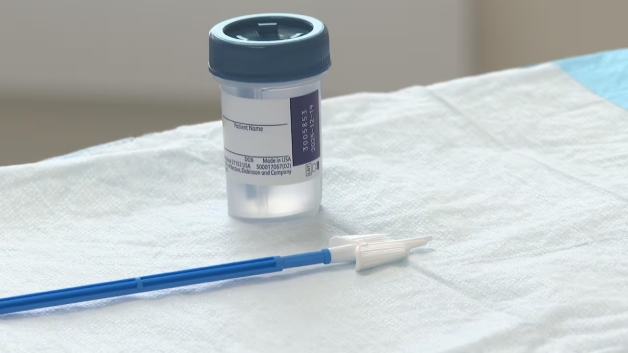 Tìm hiểu về xét nghiệm HPV giúp sàng lọc ung thư cổ tử cung