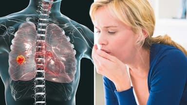 5 Dấu hiệu ung thư phổi giai đoạn đầu không thể bỏ qua