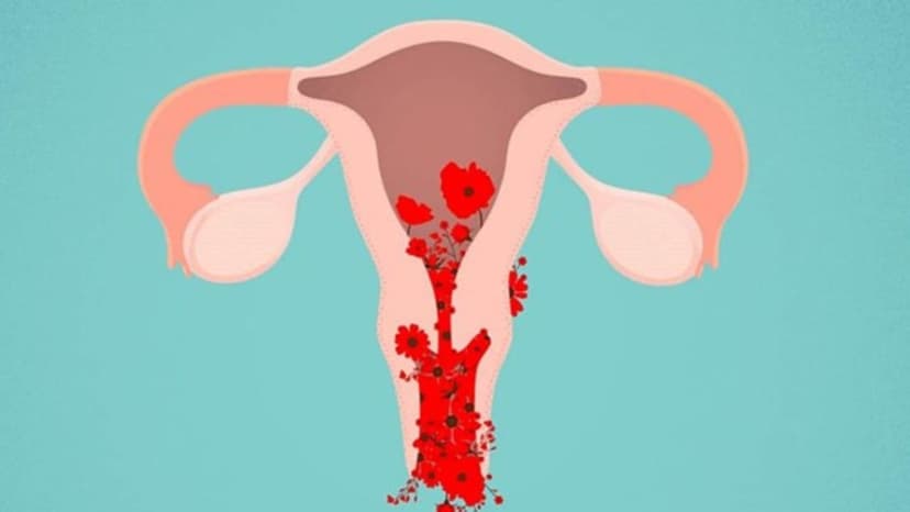 Rong kinh là gì và dấu hiệu rong kinh chị em không nên bỏ qua