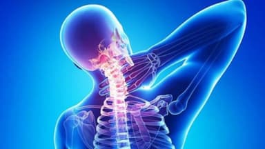 Các bệnh thường gặp ở đốt sống cổ