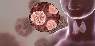 Giải đáp u tuyến giáp lành tính có cần mổ không?