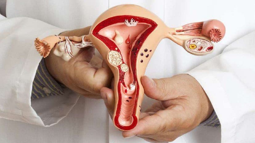 Ung thư cổ tử cung: Tỉ lệ sống và phương pháp điều trị