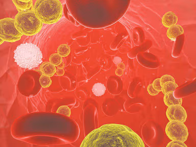 Sự nguy hiểm của bệnh phế cầu và vacxin phế cầu phòng bệnh