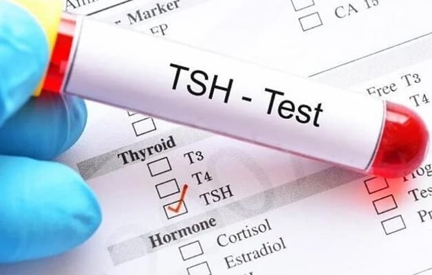 Xét nghiệm chức năng tuyến giáp rất quan trọng trong chẩn đoán và điều trị bệnh.