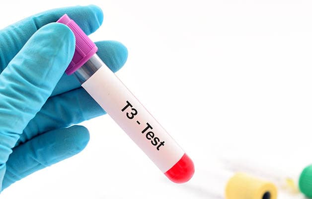 Nồng độ T3 bất thường có thể là dấu hiệu của bệnh tuyến giáp.