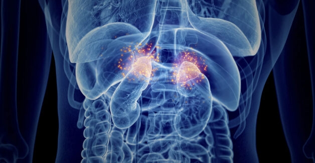 Hình ảnh suy tuyến thượng thận