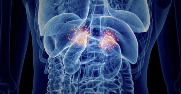 Hình ảnh suy tuyến thượng thận