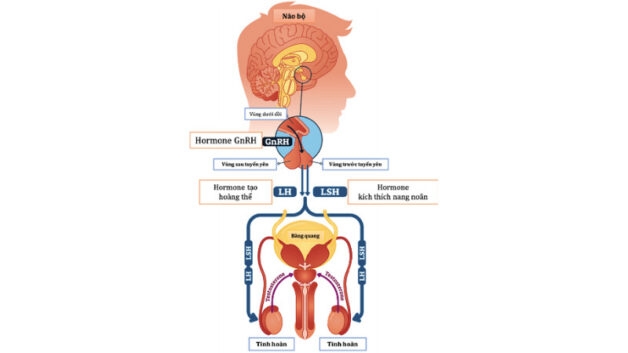 Sử dụng liệu pháp hormone GnRH nếu tuyến yên sản sinh ra quá ít hormone