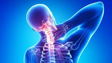 Thoái hoá cột sống cổ: Các biến chứng nguy hiểm có thể xảy ra