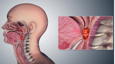 Điều trị ung thư vòm họng với phác đồ trúng đích