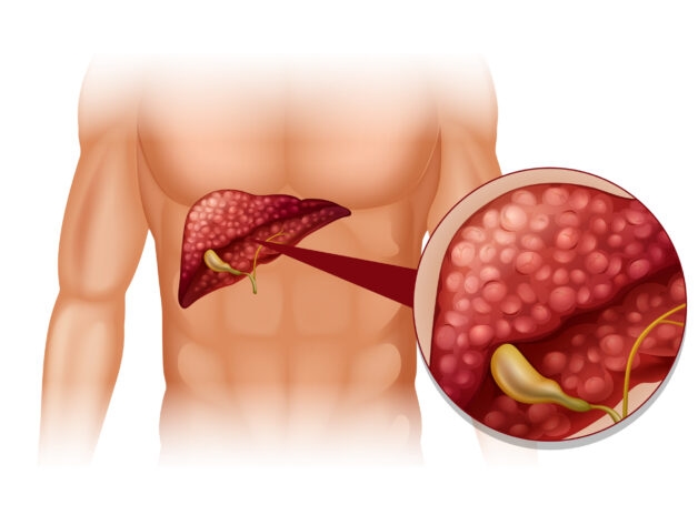 Các dấu hiệu cảnh báo bệnh.