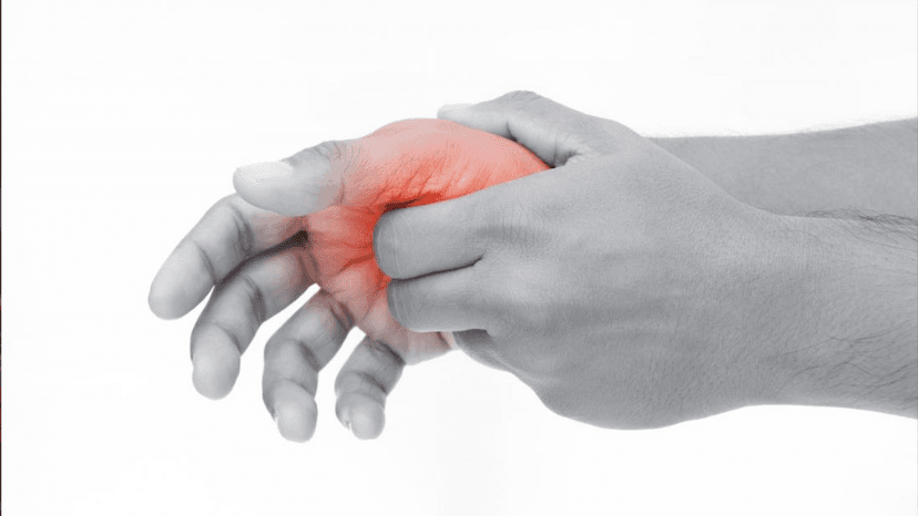 Những điều cần biết về hội chứng De Quervain