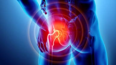 Tìm hiểu bệnh thoái hóa khớp háng và cách để phòng ngừa
