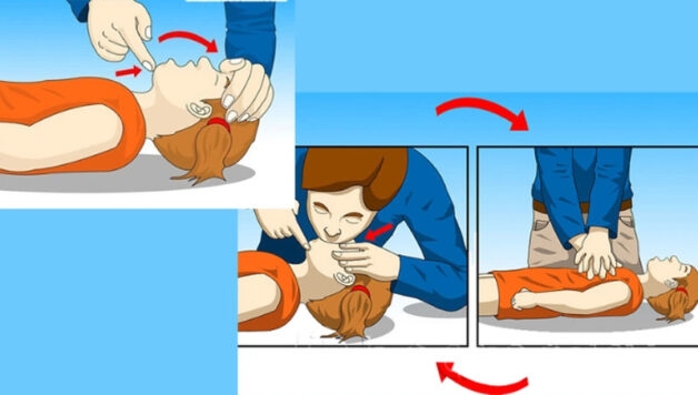 Tránh hô hấp nhân tạo khi người bệnh lên cơn động kinh