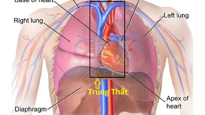 Hiểu về bệnh u trung thất ác tính và lành tính