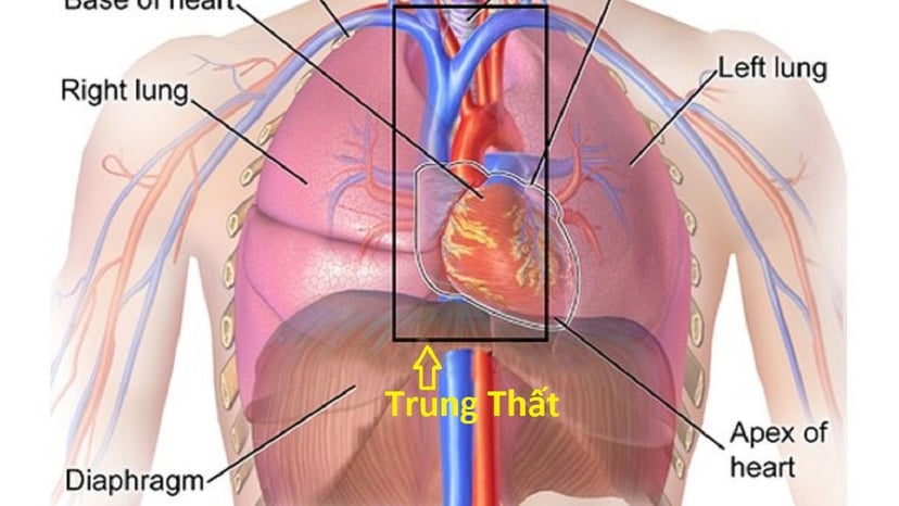 Hiểu về bệnh u trung thất ác tính và lành tính