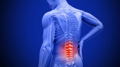 Phương pháp phục hồi chức năng thoái hóa cột sống thắt lưng