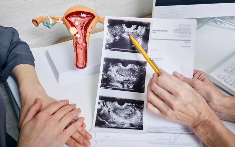 viên đặt âm đạo