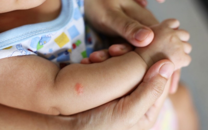 lưu ý sử dụng thuốc bôi muỗi đốt
